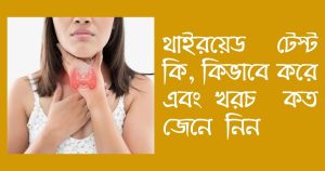 থাইরয়েড টেস্ট কিভাবে করে এবং খরচ কত জেনে নিন