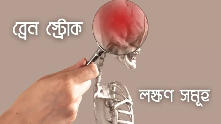 ব্রেন স্ট্রোক এর লক্ষণ